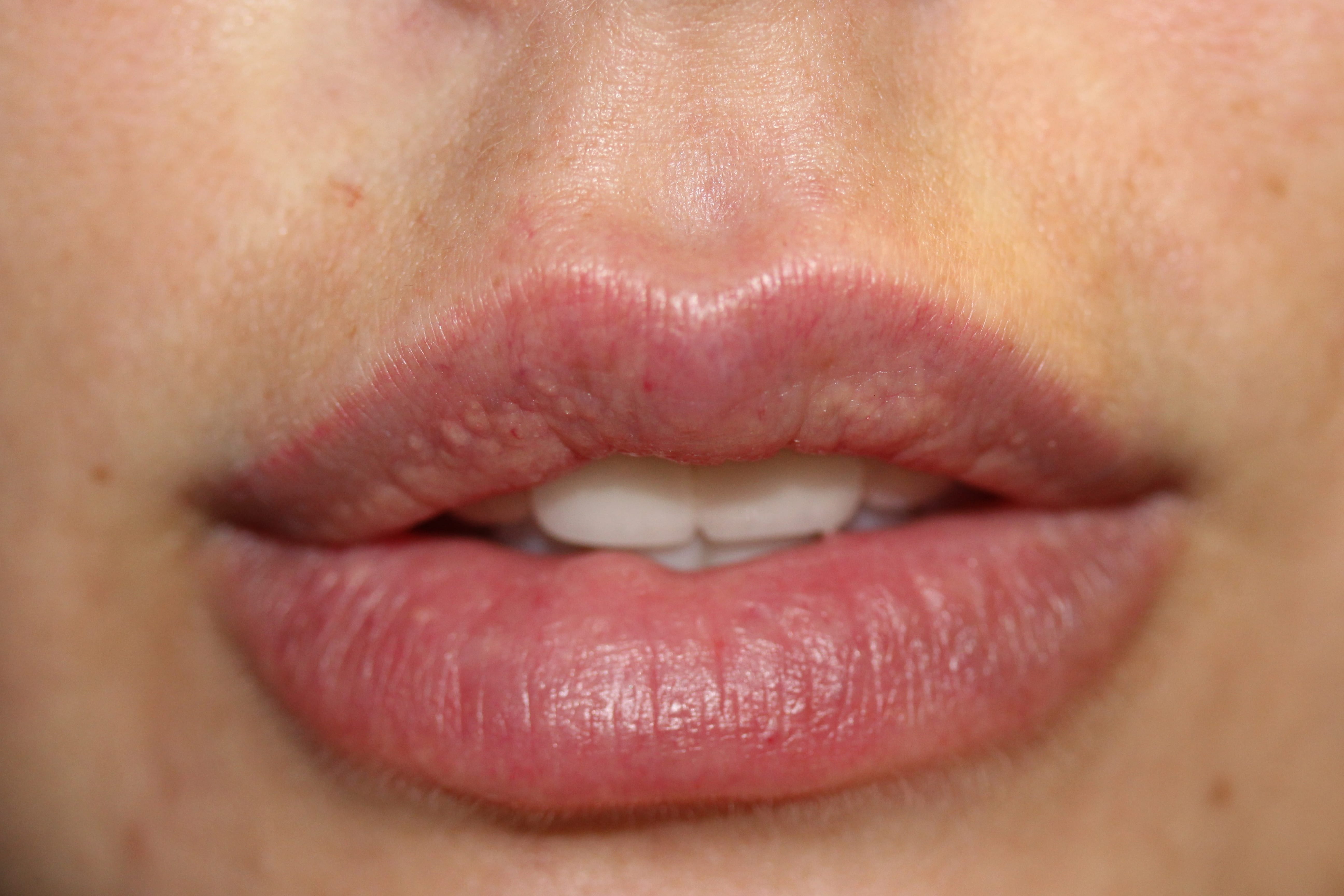Permanent makeup lips before and after
