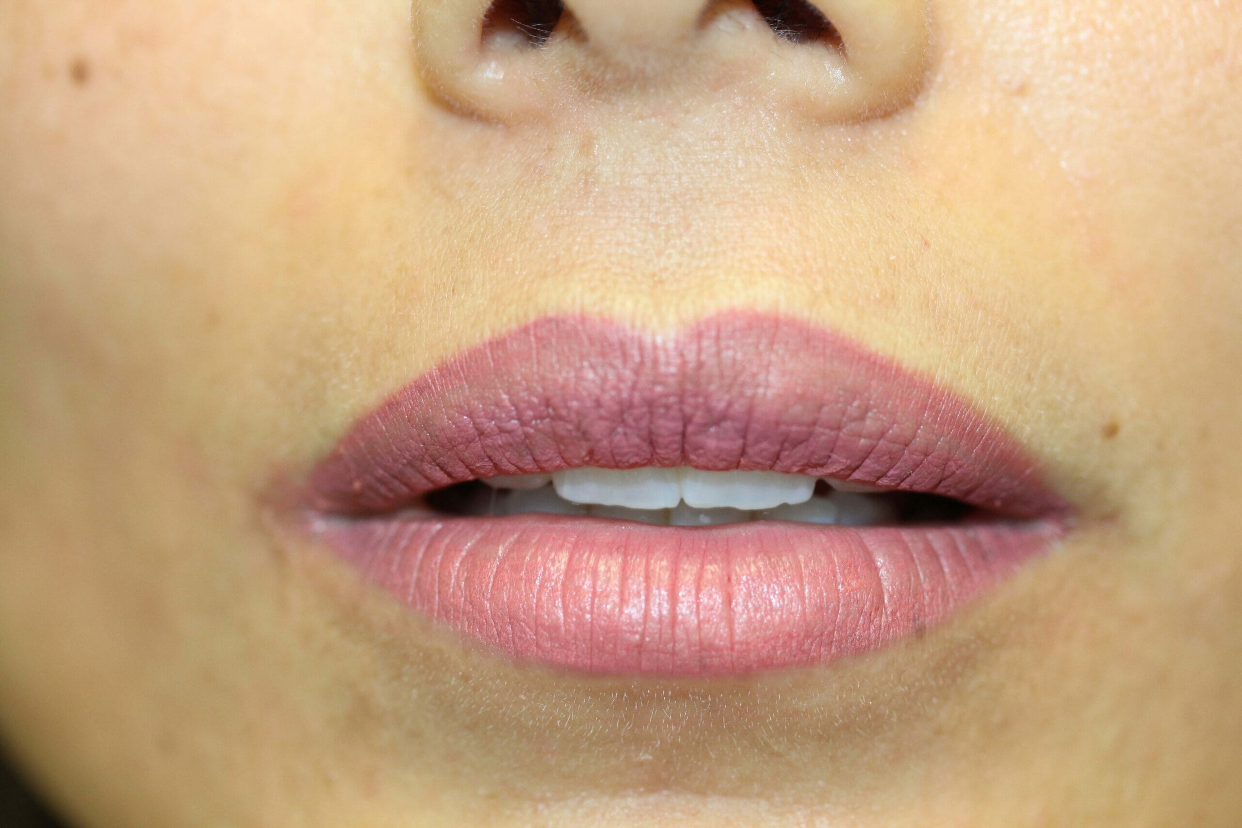 Lip Liner Before and After Photos - Ruth Swissa