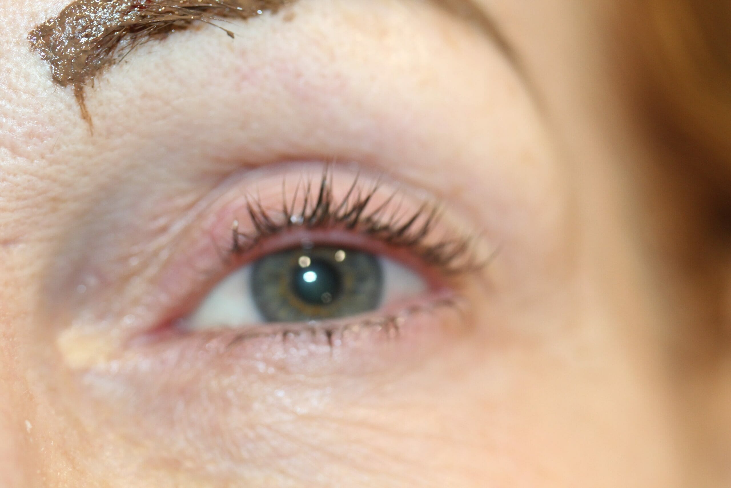 Permanent Eyeliner Before And After Photos
