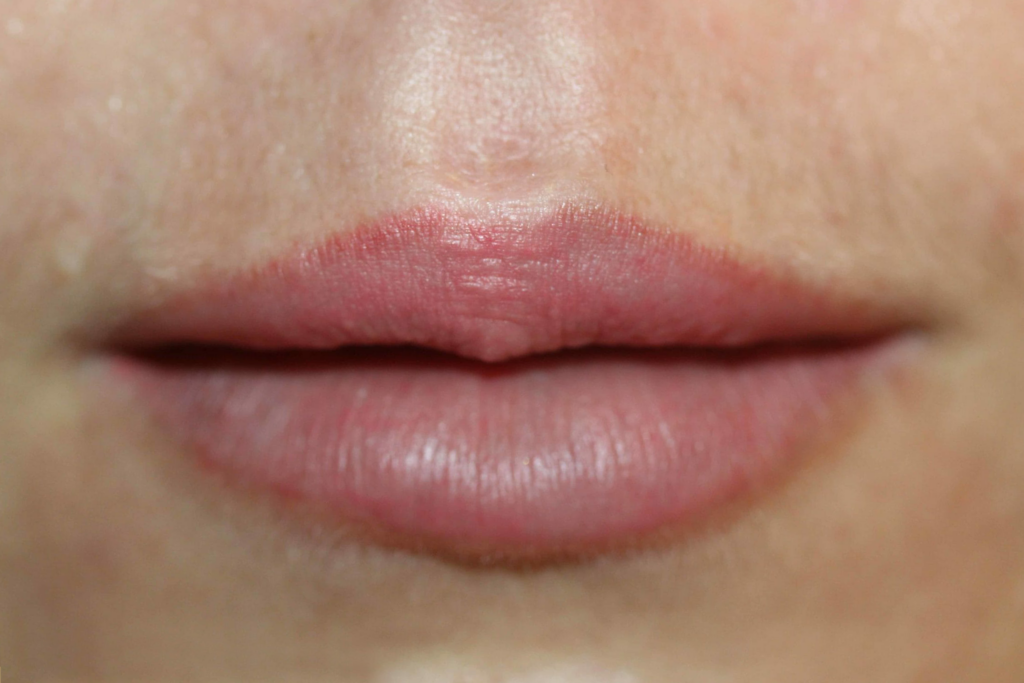 Ruth Swissa Permanent Lip Blush Dog bite