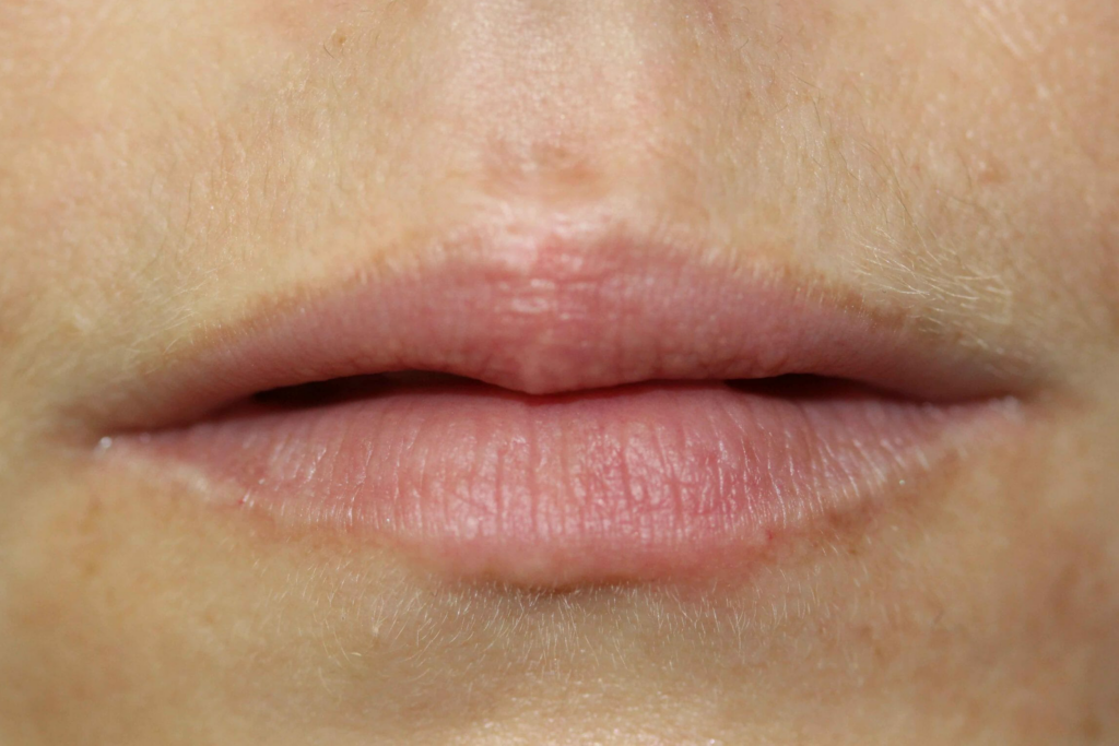 Ruth Swissa Permanent Lip Blush Dog bite